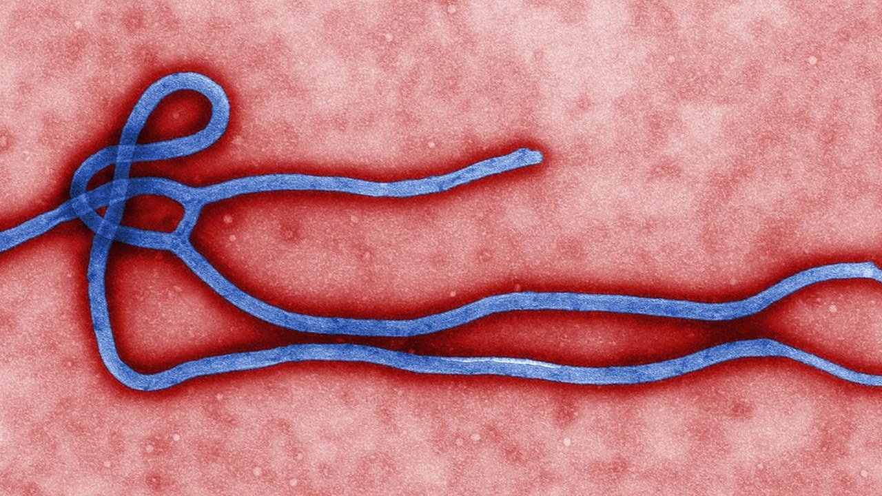 Stand-in: colorized CDC electron micrograph of a single Ebola virus particle, not a photo from the affected provinces